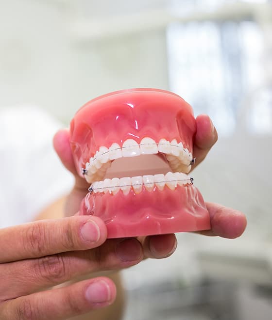Complete Dentures