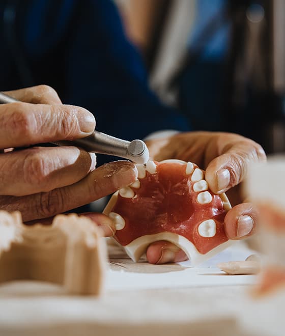 Denture Repairs