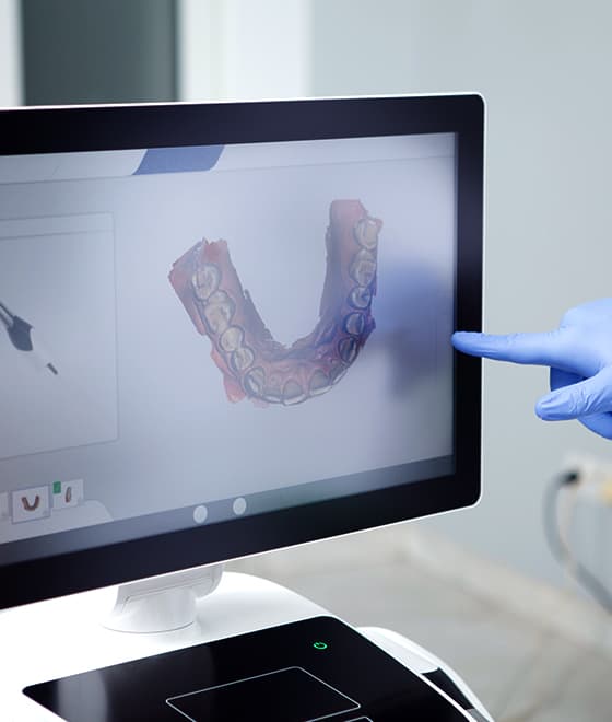 Digital Dentures