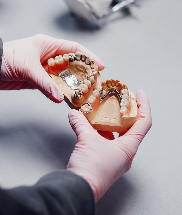 PARTIAL DENTURES
