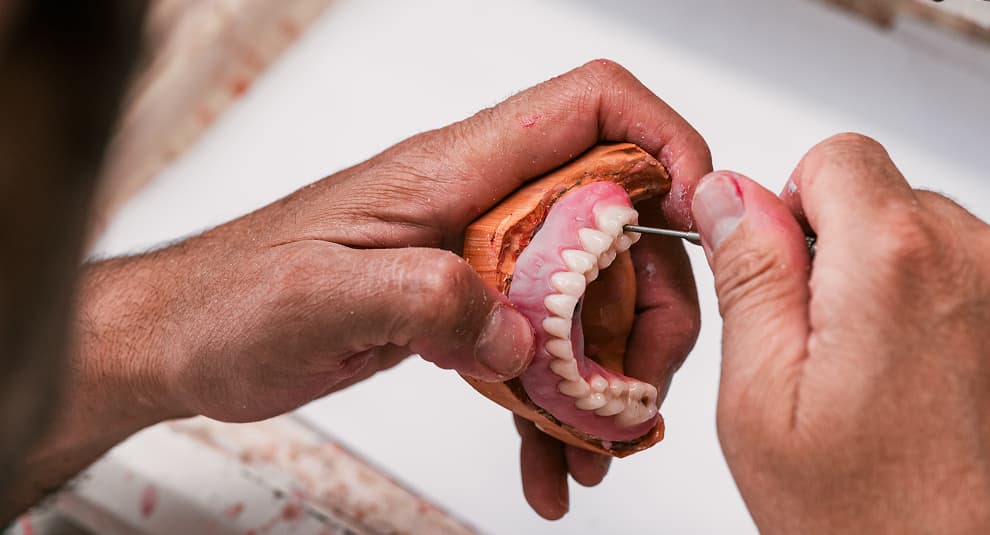 5 Signs Your Dentures May Need an Adjustment or Reline
