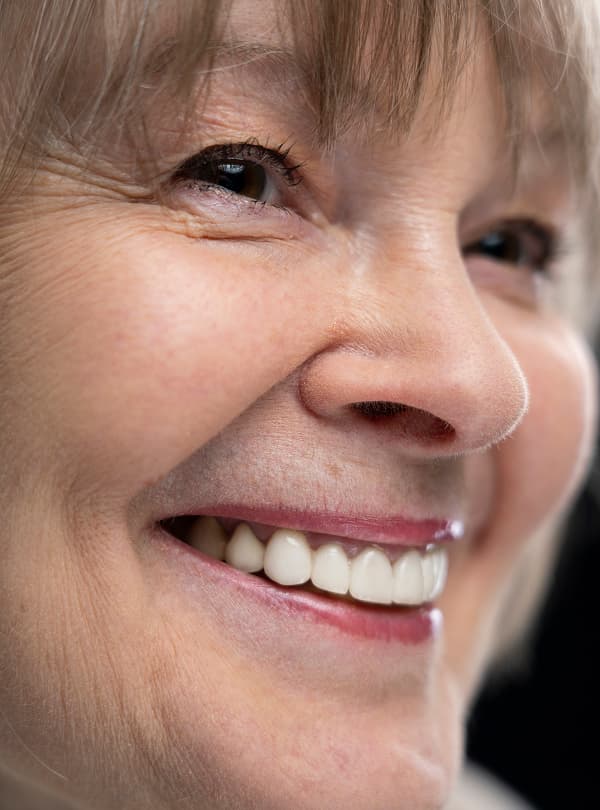 Removable Partial Dentures