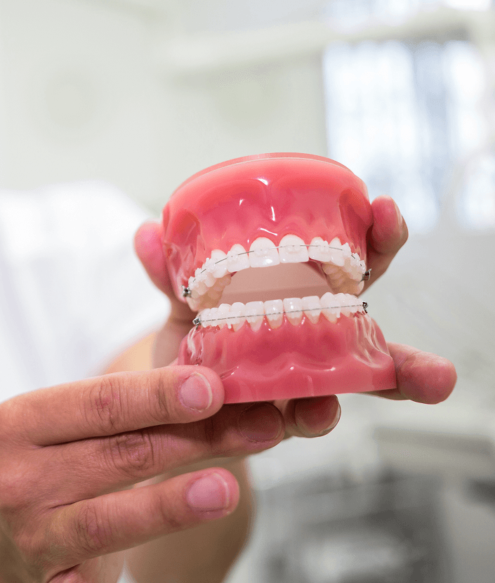 Complete Dentures