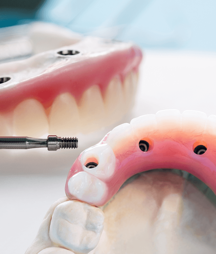 SECURE STABILITY, EASY CHEWING & CONFIDENCE
