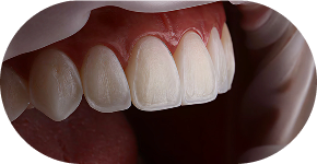 Rebases